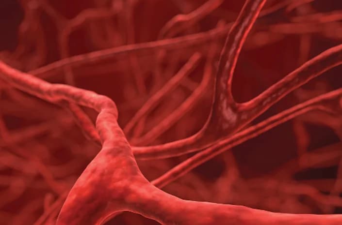 Santé veineuse : varices et hémorroïdes
